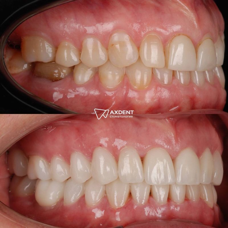 �������� � ����� ������: �� ������ ��������, � ��������